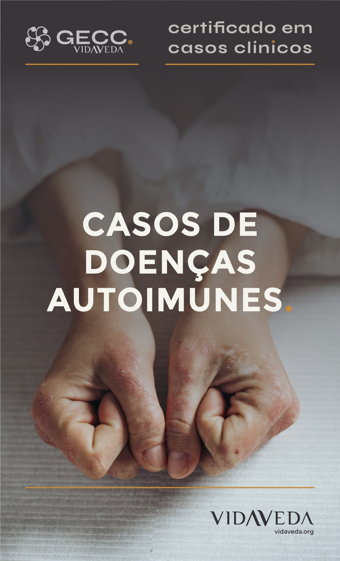 GECC -  CASOS DE DOENÇAS AUTOIMUNES